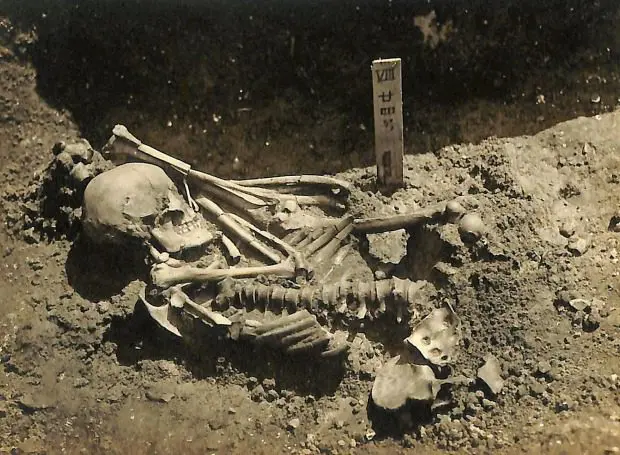 Archaeologists find the oldest shark attack victim