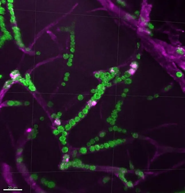 Green Algae in Tadpole Blood Vessels