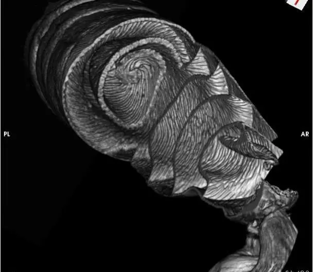 Shark Intestine Reveals Like Nikola Tesla’s Valve