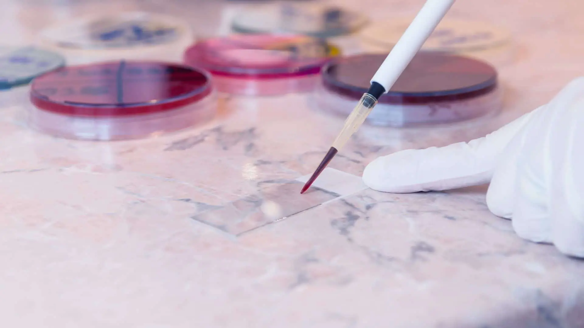 The Acute Leukemia Advocates Network and Scientific Education Support announce new strategic collaboration in acute leukemia