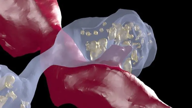 Dopamine Axons Swelling