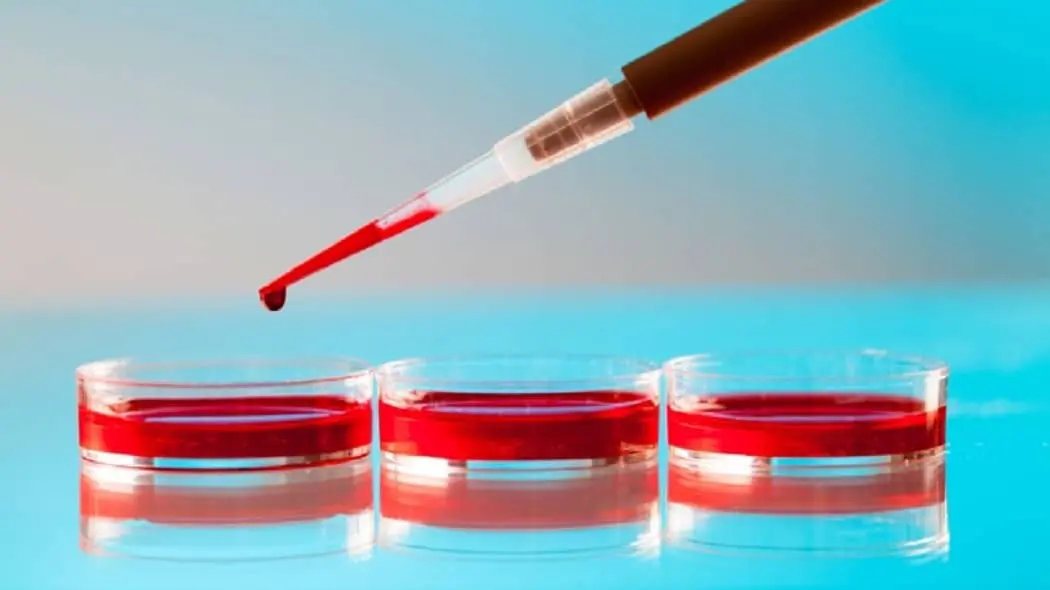 Three biomarkers of brain damage found in the blood of astronauts