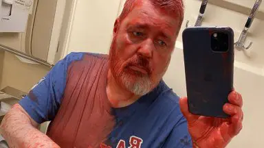 Russian Nobel Peace Prize winner was attacked with red paint