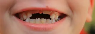 A 130,000-year-old baby tooth