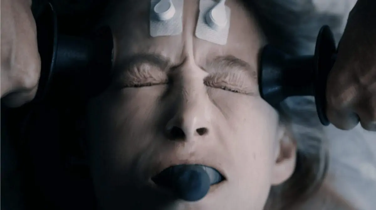 ECT – what the United Nations says about Electroshock