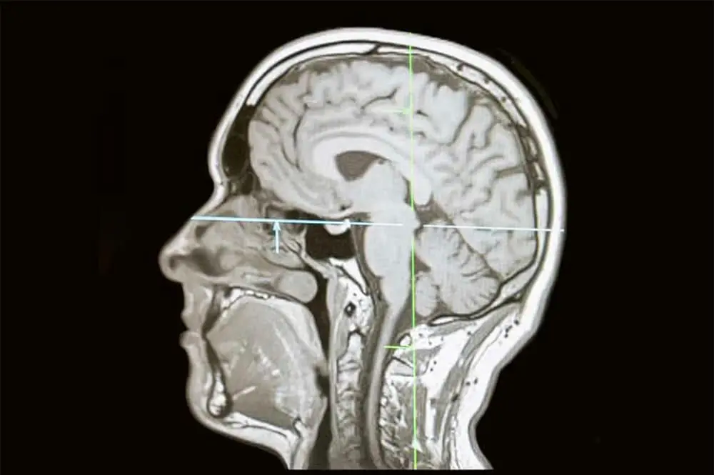 Mental health and psychological care of the child: the impasses of the “all biological” approach