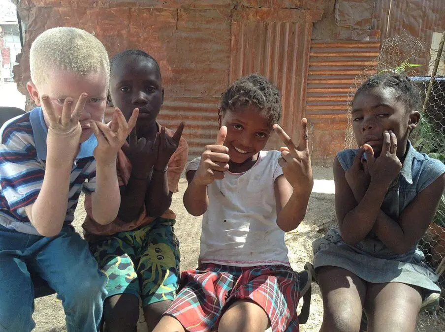 Albino Children: Superstitions in Africa