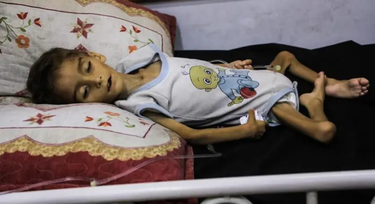 Gaza: Acute malnutrition among children hits record high