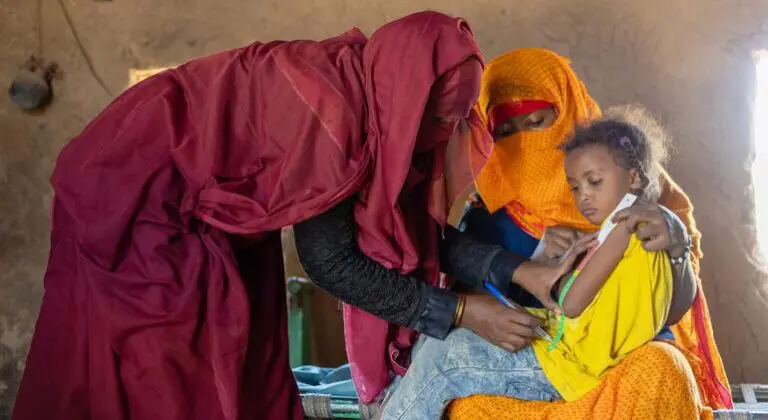 Child malnutrition hits catastrophic levels in parts of Sudan