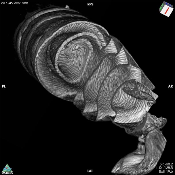 CT Scan Aiguillat commun Requin Spirale Intestin