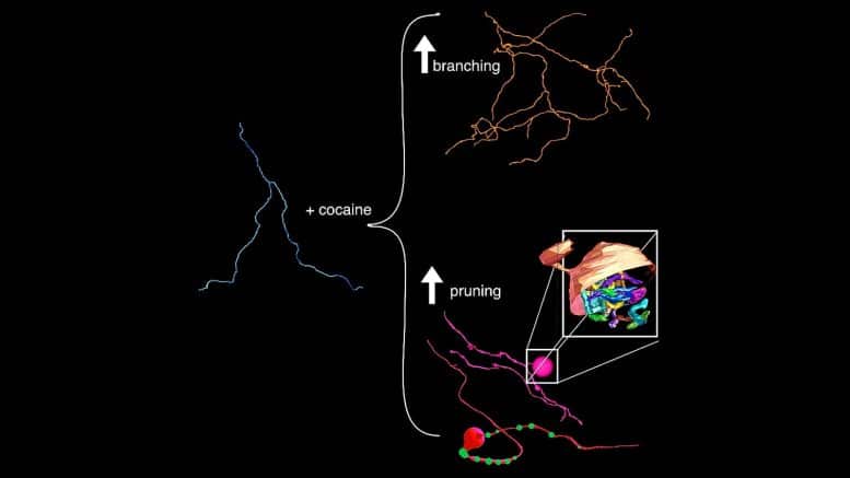 Connectomic Analysis Cocaine Brain