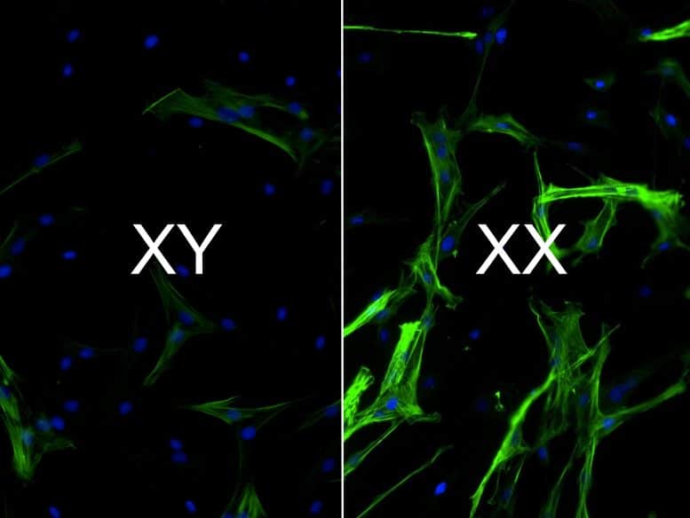 Ткань сердца XX против хромосом XY