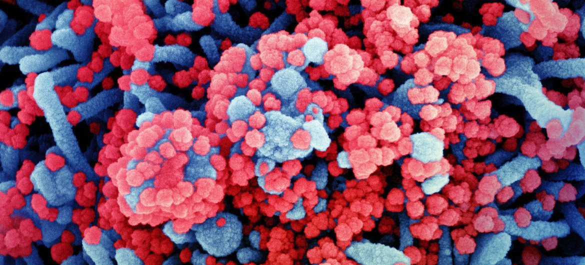 Micrographie électronique à balayage colorisée d'une cellule (bleue) fortement infectée par des particules de virus SARS-CoV-2 (rouge).