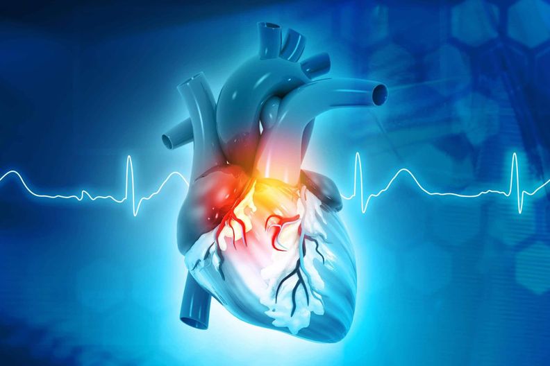Concept de maladie de fréquence cardiaque