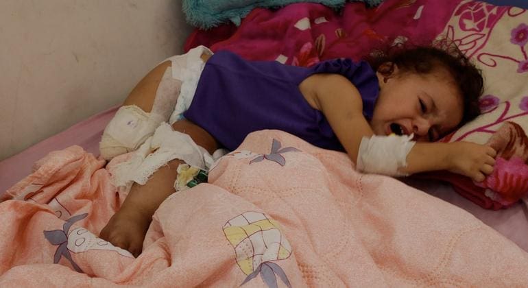 Driven by hunger in Gaza, amputees are part of the collateral damage Driven by hunger in Gaza, amputees are part of the collateral damage